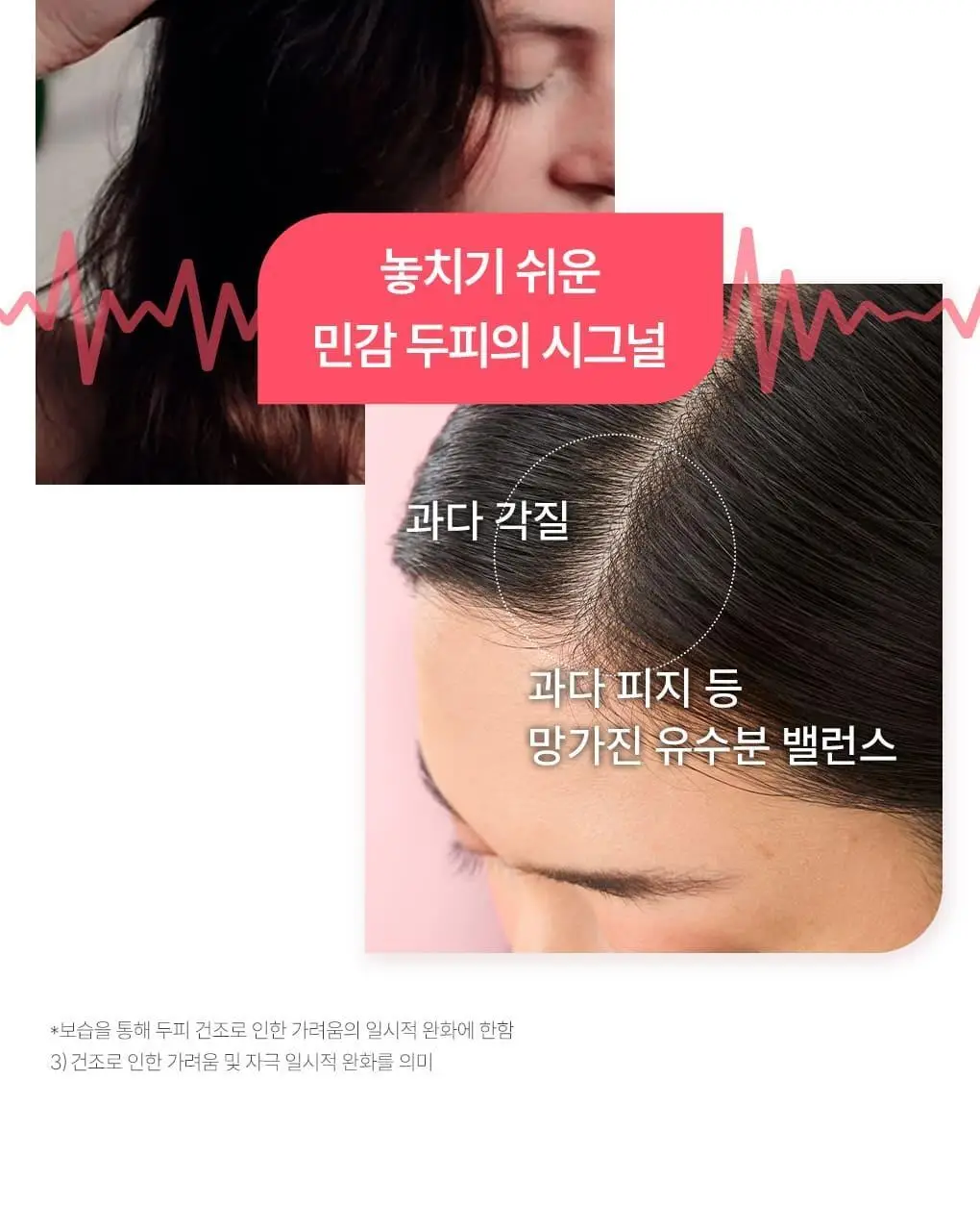 [민감두피 & 두피진정 트리트먼트] 클로란 피오니 두피팩 150ml 기획세트 / 단품 상세페이지 6